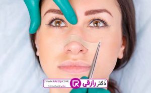 عوامل تاثیرگذار بر روی قیمت عمل بینی استخوانی