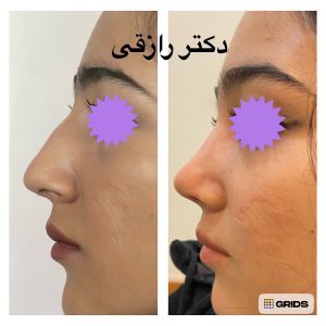 Snapinsta.app_1080_324552261_2510953412378101_2292794139720599381_n