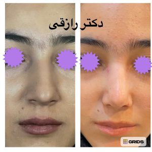 Snapinsta.app_1080_324717239_137776575797054_5395642902616409734_n