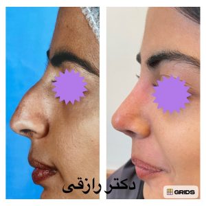 Snapinsta.app_1080_325300775_698319828502641_967804177791401055_n