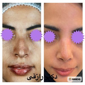 Snapinsta.app_1080_325524927_215873150840527_971788040189127378_n