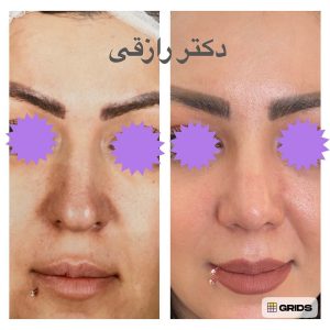 Snapinsta.app_1080_326160762_1866311280398142_7461174327774532831_n (1)