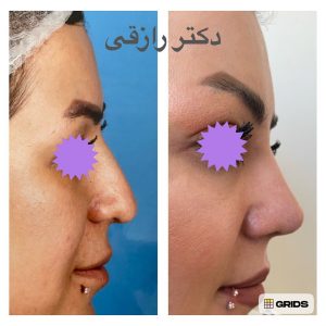 Snapinsta.app_1080_326161260_729356291936555_623780574999804985_n