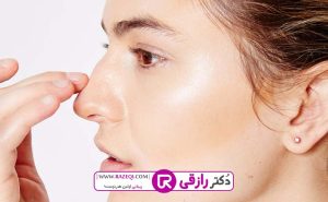 هزینه عمل بینی نیمه فانتزی
