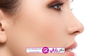 هزینه عمل بینی نیمه فانتزی