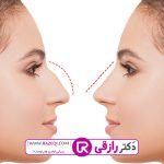 2قالب تصویر رازقی 150x150