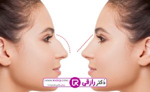 2قالب تصویر رازقی 300x185