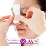 عمل بینی شکسته