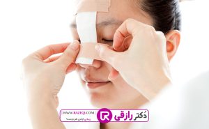 عمل بینی شکسته