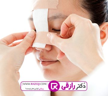 عمل بینی شکسته