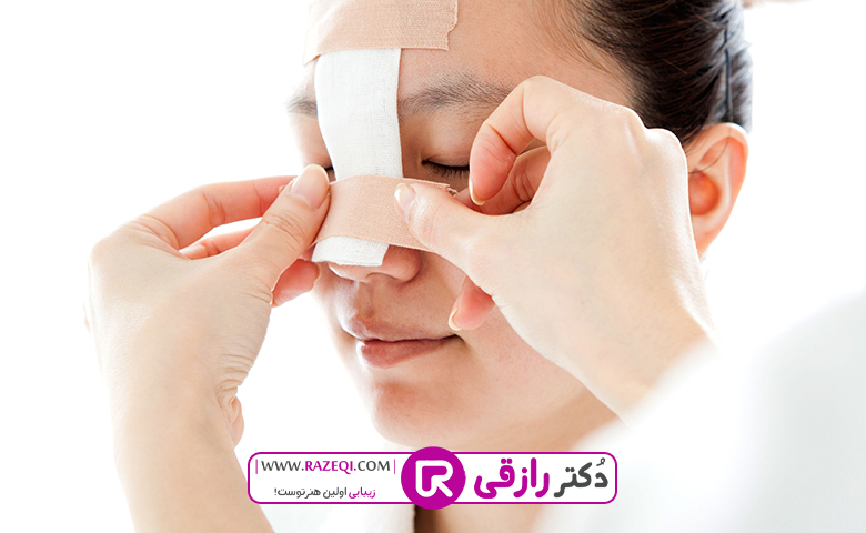 عمل بینی شکسته
