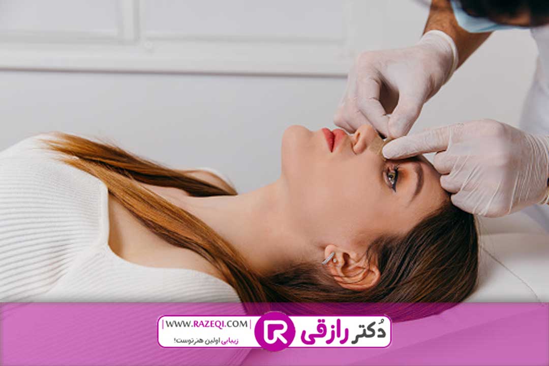 عمل بینی شکسته