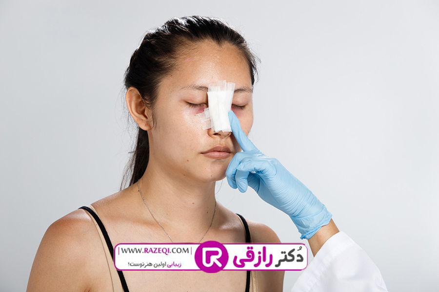 جراحی بینی سعادت اباد