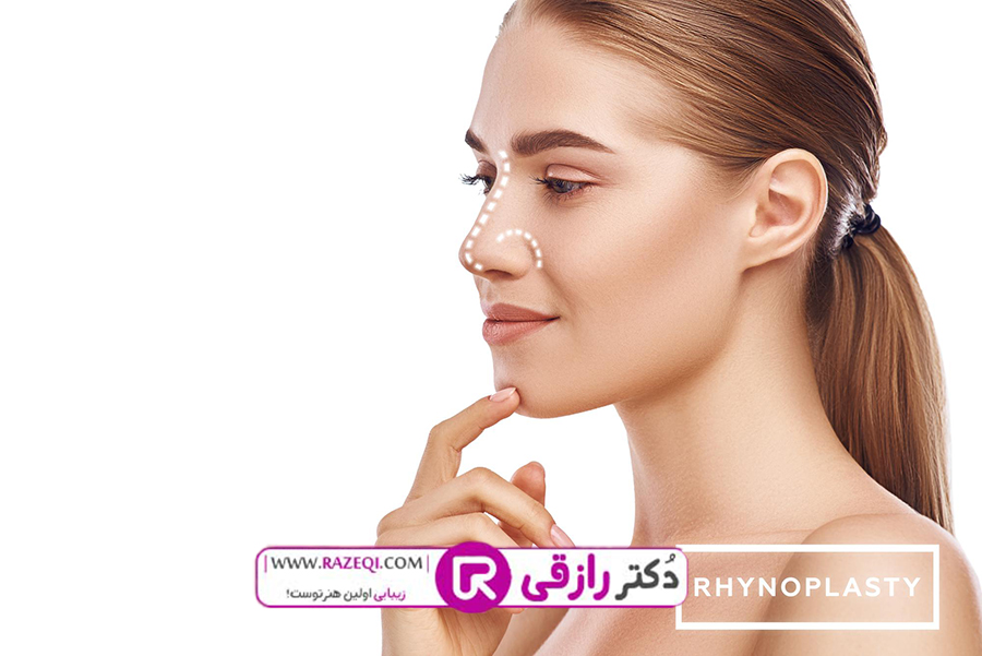 جراحی بینی سعادت اباد